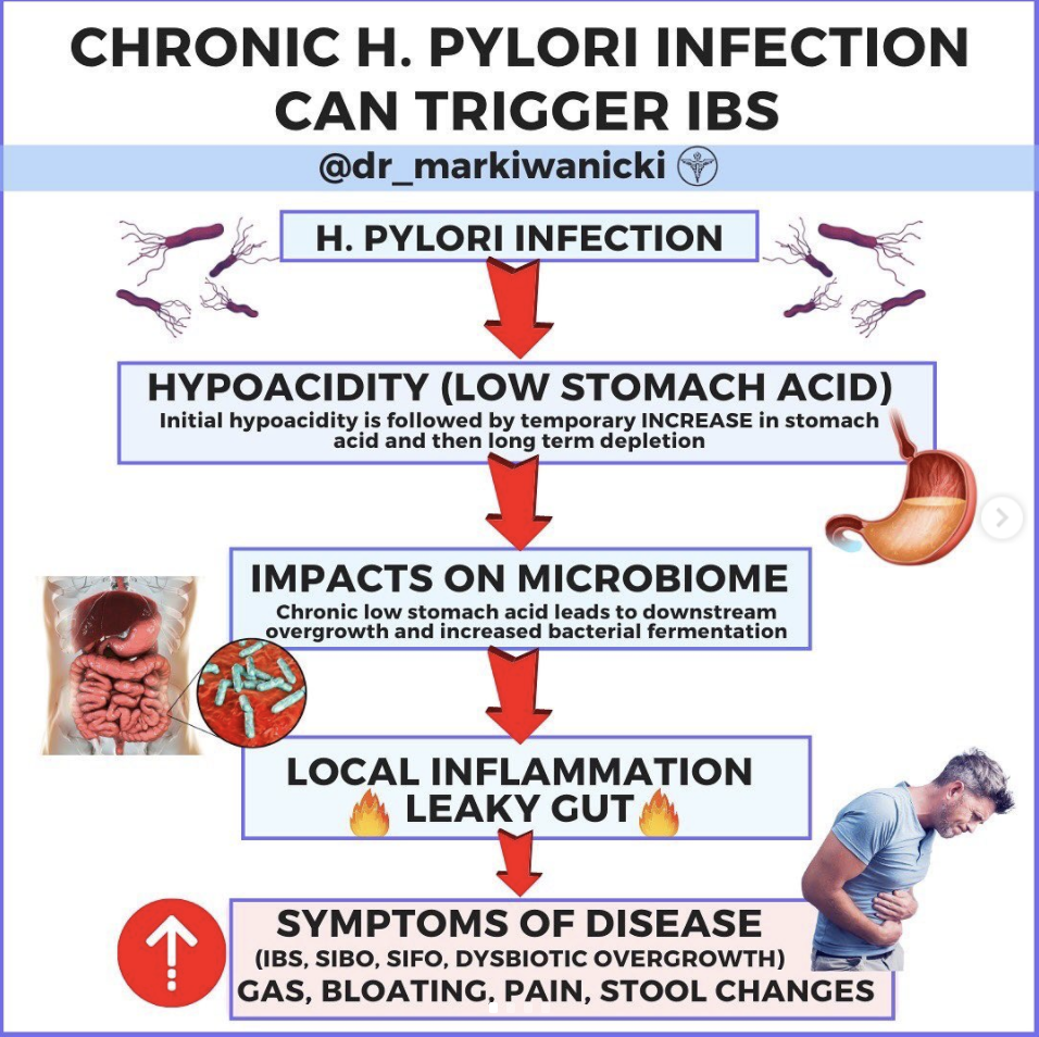 H. Pylori, Stomach Acid and Irritable Bowel Syndrome